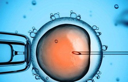 卵巢早衰会出现什么症状？做试管婴儿成功率怎么样？