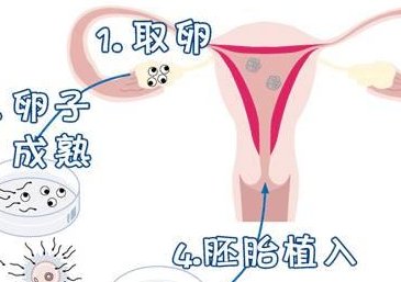 国内哪里做试管不用结婚证？哪些国家做试管不需要结婚证